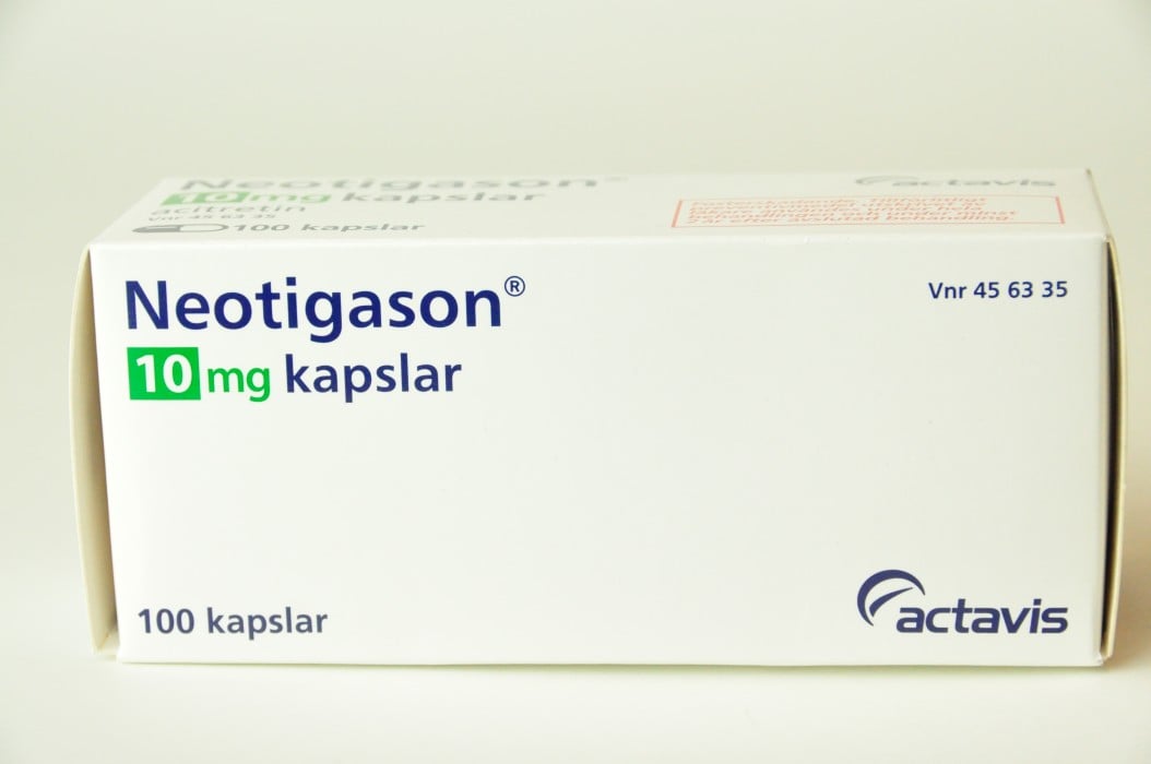Neotigason, kapsel, hård 10 mg Teva Sweden AB - 100 styck